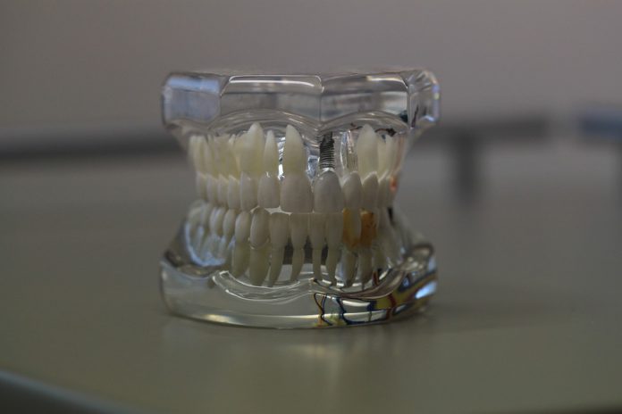 ¿Qué pasa cuando no reponemos los dientes extraídos?